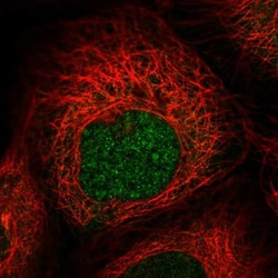 ZNF577 Antibody, Novus Biologicals 25 &mu;L, Unlabeled:Antibodies, Polyclonal